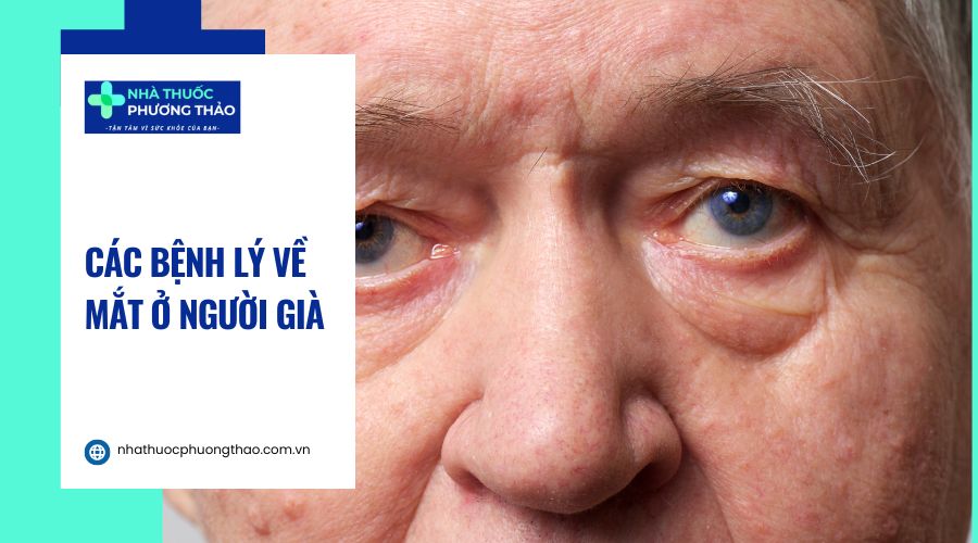 Các bệnh về mắt ở người già
