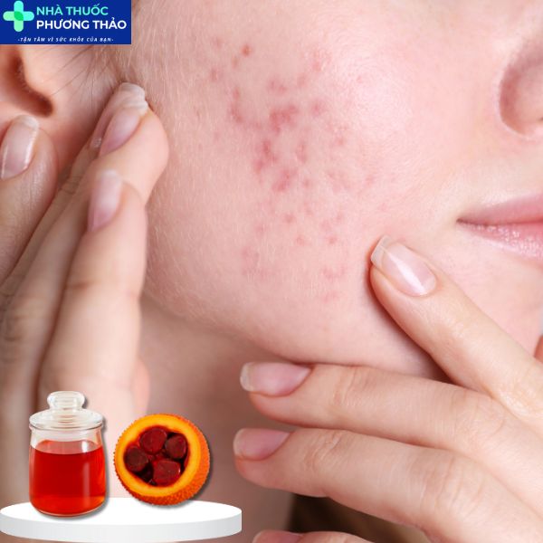 công dụng của dầu gấc trong làm đẹp 5